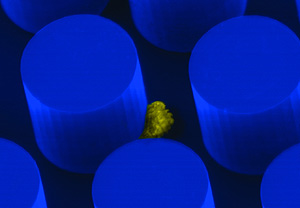 Una célula cancerosa se adhiere a uno de los orificios del chip (Foto: H. Massachusetts)